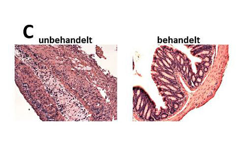The untreated inflamed bowel wall (left) is full of immune cells (black dots) and has lost almost the entirety of its mucous membrane. The wall of the bowel treated with capsazepine (right) is normal and its mucous membrane is intact.