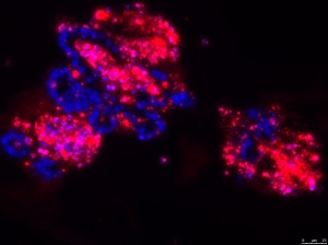 Microscopic image of intestinal epithelial cells in a petri dish. Without the molecule cFlip, the cells die en masse. Nuclei are shown in blue. (Image: Dr. Nadine Wittkopf, Department of Medicine 1)