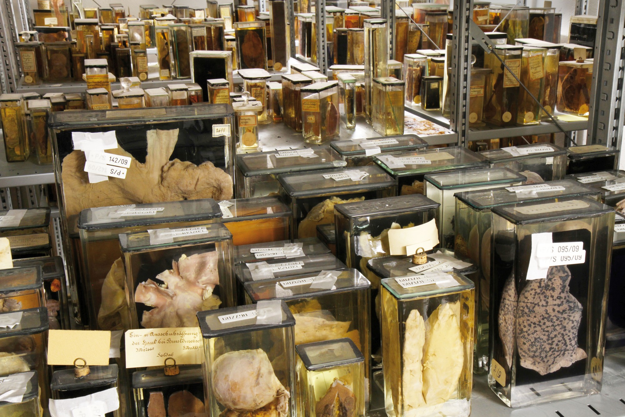 In the foreground is a row of preparations that have been restored along with preparations that have recently been logged in the inventory. (Image: Georg Pöhlein)