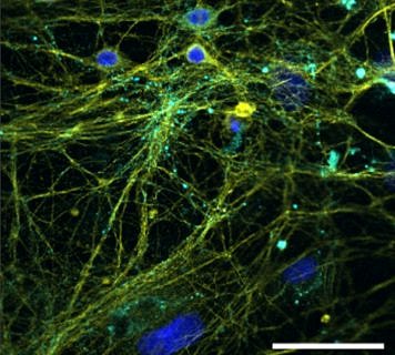 Fluorescence microscopy image: SOFA causes the cytoskeleton of the neurons (yellow) and the synapses (turquoise) to fluoresce; the nuclei are here shown in blue. The scale bar at the bottom of the picture is equivalent to 50 μm. (Image: Marc Dahlmanns)