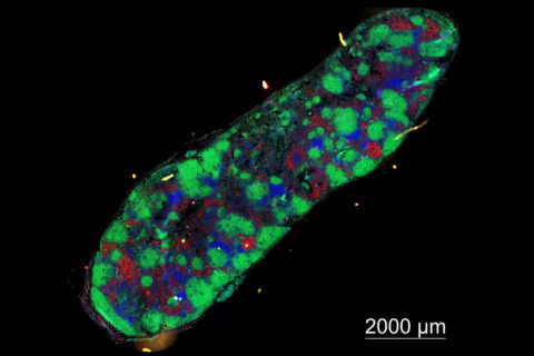 Der Lymphknoten einer an SLE erkrankten Maus, in dem es zu einer starken Vermehrung Autoantikörper-produzierender Plasmazellen (in rot dargestellt) gekommen ist. Neben den Plasmazellen sind auch B-Zellen (grün) und T-Zellen angefärbt, deren Zusammenspiel die Grundlage für die spätere Autoimmunantwort ist.