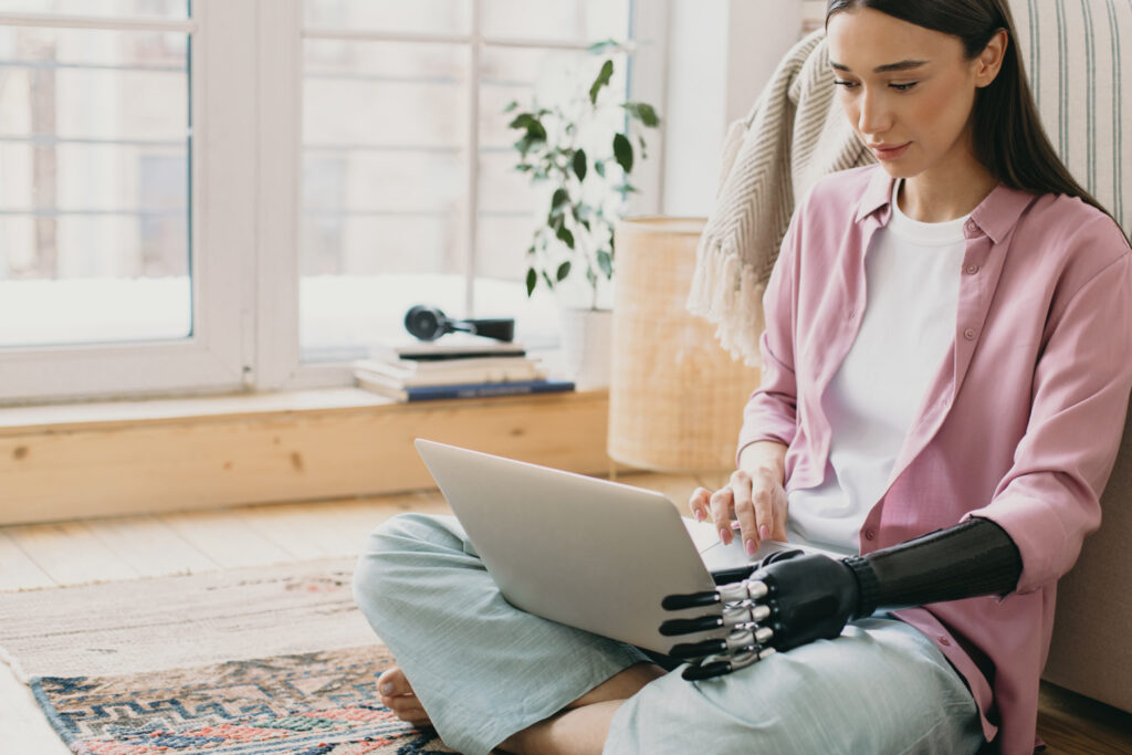 Woman holding laptop on her legs, one hand is a prosthesis.