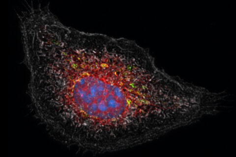 A macrophage activated by an inflammatory stimulus after being treated with cortisone.