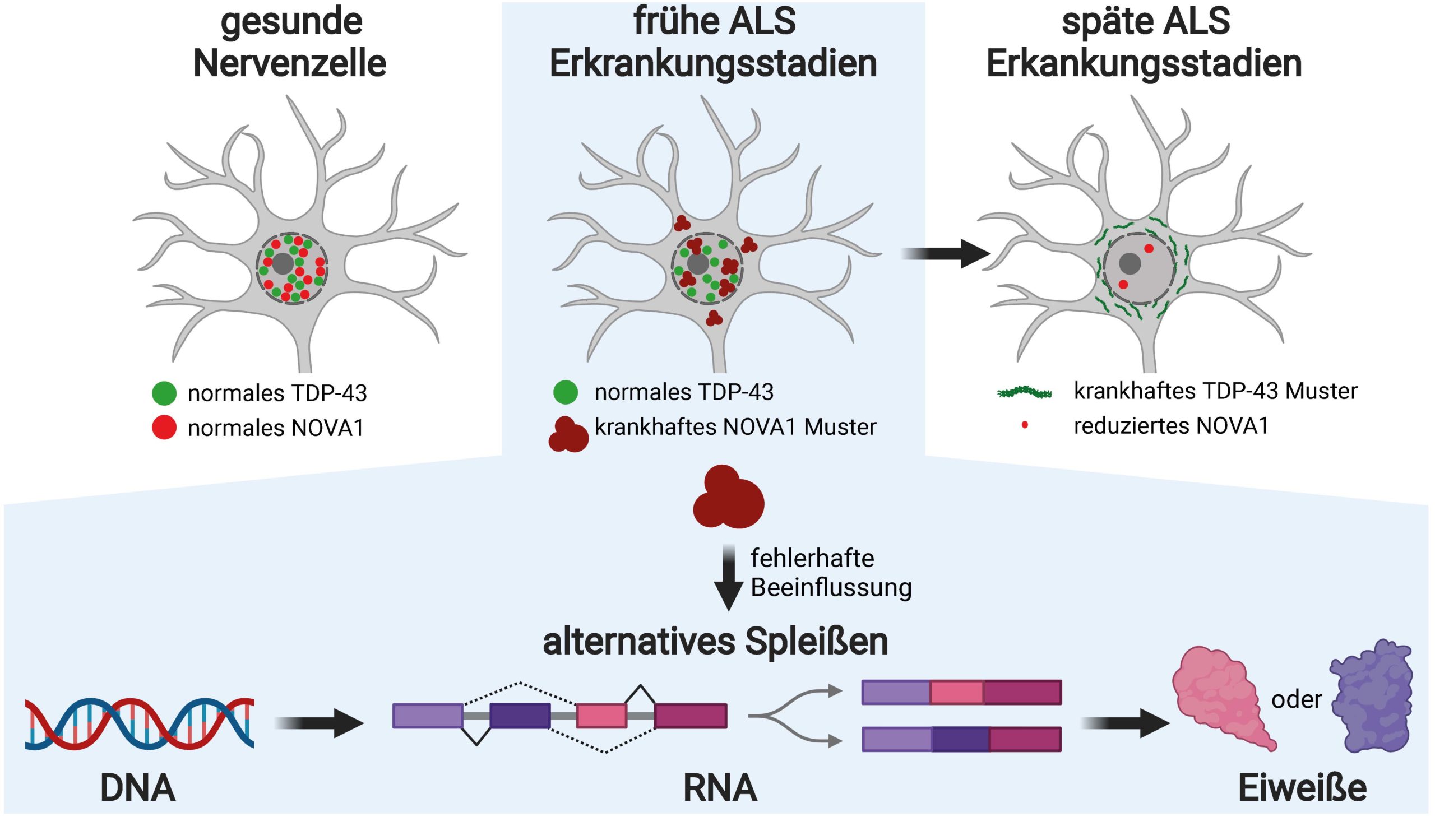 tages of development in a nerve cell affected by ALS