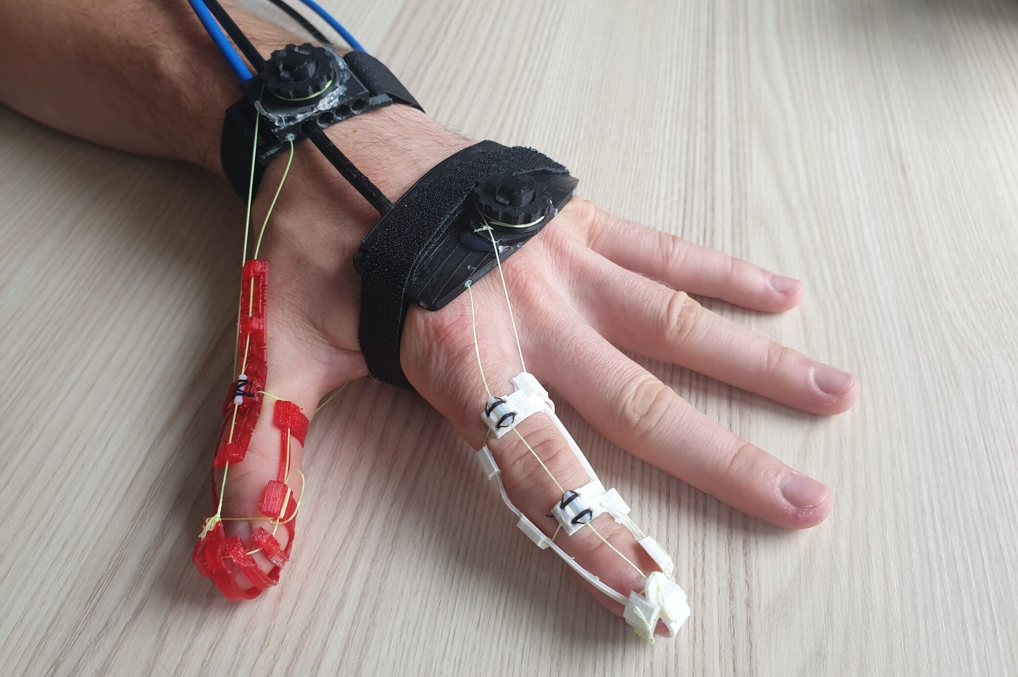Patients with limited hand function are soon set to benefit from an intelligent neuro-orthosis that will enable them to lead independent lives again. Prof. Dr. Alessandro Del Vecchio, a neuroscientist at FAU, is working on this aim in two new projects and has received over 1.3 million euros of funding from the Free State of Bavaria.