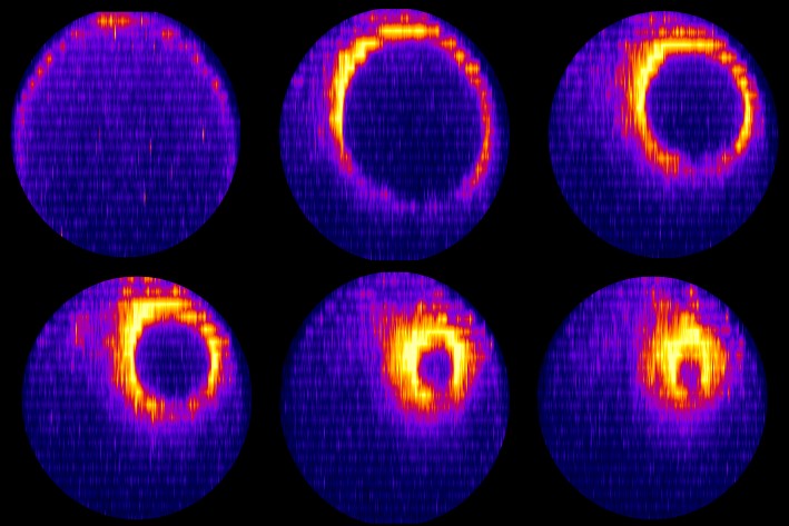 Cell research: One becomes two in 20 minutes