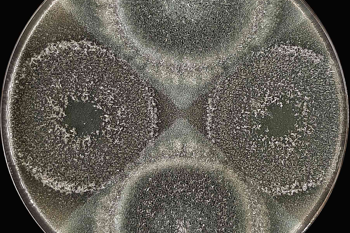 Microscopic black and white scan of a hybrid plate of the mold Aspergillus fumigatus.