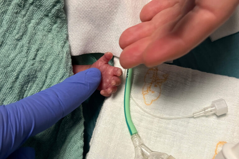 Neonatology: Intelligent suctioning system protects newborns