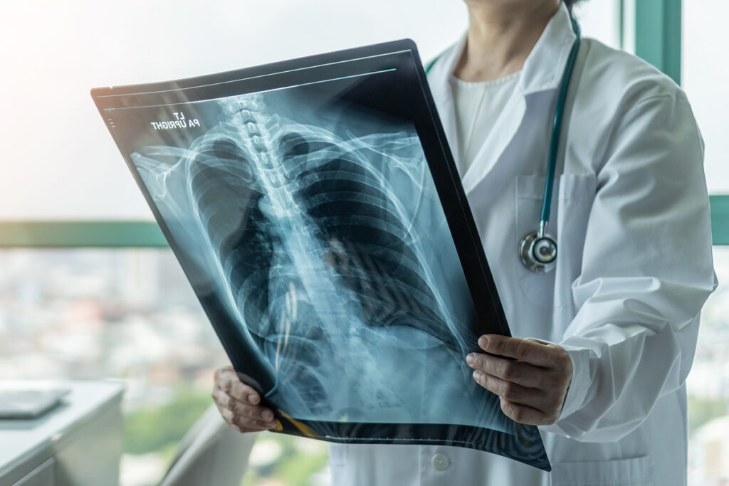 Arzt, der die Diagnose Asthma, Lungenkrankheit, COVID-19, Coronavirus oder Knochenkrebs stellt, mit radiologischem Röntgenfilm des Brustkorbs für die medizinische Versorgung im Krankenhaus