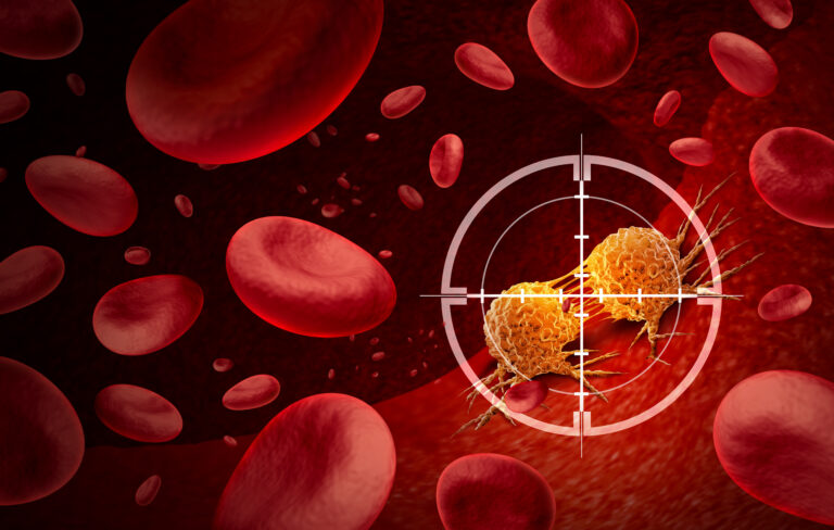 New approach to combat rejection after stem cell transplantation